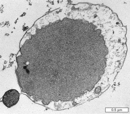 The exceptionally small cell in the image shown below is an obligate symbiont to another archaeon and a member of the genus   A)  Archaeoglobus. B)  Ignicoccus. C)  Pyrococcus. D)  Ferroplasma. E)  Nanoarchaeum.