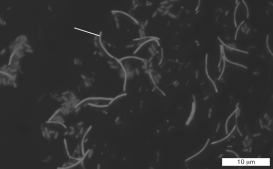 In wastewater, the bacteria are packed together by filamentous ________ to form sludge.   A) halophiles B) thermophiles C) methanogens D) psychrophiles E) acidophiles