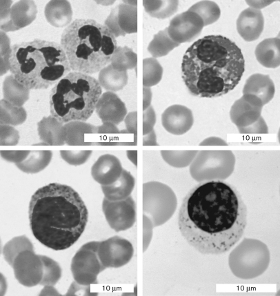 Which structure engulfs microbes by phagocytosis?   A) hair follicle B) sebaceous gland C) blood vessels D) sweat glands E) subcutaneous tissue