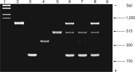 The figure shown below is a picture of a gel with multiplex PCR products from Clostridium botulinum isolates. Lane 1 contains DNA molecular weight markers and lanes 2-5 are positive strains as controls for toxins type A, type B, type E, and type F, respectively. Based on the bands shown, what can we say about the isolate results in lane 6?   A)  The isolate in lane 6 produces all four toxins but not endotoxin. B)  The PCR products from isolate in lane 6 are consistent with that isolate having toxins A, F, and B but not E. C)  The isolate in lane 6 produces all four toxins. D)  There is no band for endotoxin in lane 6 but the isolate makes three other toxins. E)  The gel shows definitive proof that this strain produces three toxins.
