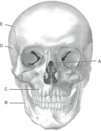 Fill in the correct labels for the following figure using the word bank below.    -C __________ A) Mandible B) Maxilla C) Nasal D) Parietal E) Temporal