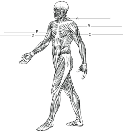 Fill in the correct labels for the following figure using the word bank below.    -E __________ A) Biceps brachii B) Deltoid C) Pectoralis major D) Serratus anterior E) Sternocleidomastoid