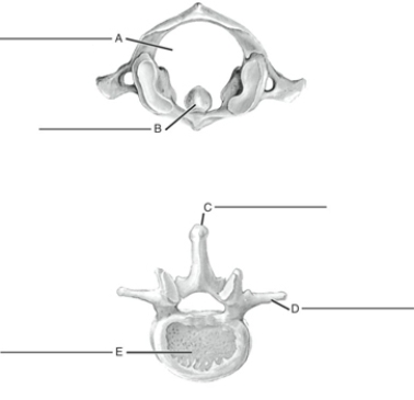 Fill in the correct labels for the following figure using the word bank below.    -A __________ A) Transverse process B) Spine C) Centrum (body)  D) Vertebral foramen E) Odontoid process of axis