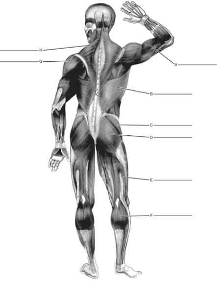 Fill in the correct labels for the following figure using the word bank below.    -D ___________ A) Biceps femoris B) Deltoid C) Gluteus maximus D) Trapezius E) Latissimus dorsi F) Gastrocnemius G) Biceps brachii H) Gluteus medius