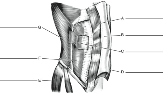 Fill in the correct labels for the following figure using the word bank below.    -G ___________ A) Tensor fasciae latae B) External oblique C) Rectus abdominis D) Aponeurosis of internal oblique E) Transversus abdominis F) Internal oblique G) Aponeurosis of external oblique
