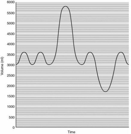   -In Figure 16.1, how many mL is the total lung capacity? A)  1700 B)  5800 C)  2200 D)  1300 E)  2800