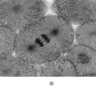       -Which of thfollowing statements is INCORRECT? A) One diploid parent cell produces two diploid daughter cells. B) Genes and chromosomes are duplicated during prophase. C) There are a specific number of chromosomes for each species. D) New nuclei are formed during telophase. E) Cytoplasmic division is the final act in cell division.