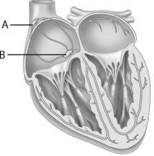   -In this diagraof thheart, which of thfollowing choices correctly identifies A anB? A) A is the AV node; B is the cardiac pacemaker. B) A is the SA node; B is the septum. C) A is the AV node; B is the SA node. D) A is the SA node; B is the AV node. E) A is the septum; B is the cardiac pacemaker.