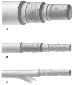    Use the above figure to answer questions -What typof bloovessel is identifieas C? A) artery B) arteriole C) vein D) venule E) capillary