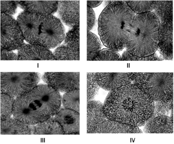    Examine the micrographs above and answer the following question(s) . -The cell in micrograph  I  is at which stage of the cell cycle? A)  prophase B)  telophase C)  interphase D)  anaphase E)  metaphase
