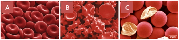 In the pictures below of red blood cells emerged in three different solutions, identify which picture corresponds to each of the following solutions.   -Hypertonic A) A B) B C) C