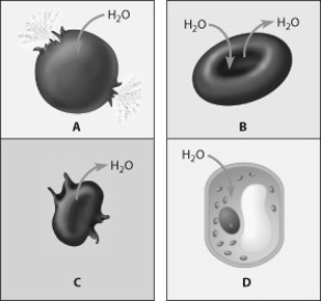 Which figure depicts an animal cell placed in a solution hypotonic to the cell?   A)  cell A B)  cell B C)  cell C D)  cell D