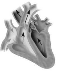 <strong>Which of the following describes the stage of the cardiac cycle shown? </strong> A) AV and semilunar valves both open, ventricles contracting B) AV valves open, semilunar valves closed, ventricles contracting C) AV valves closed, semilunar valves open, ventricles contracting D) AV valves closed, semilunar valves open, ventricles relaxed