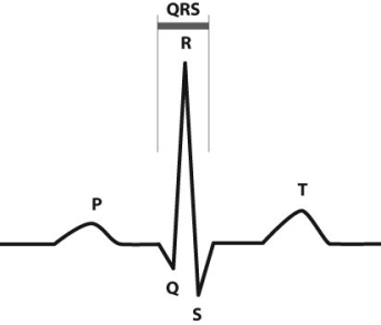 Electrocardiographs (ECGs or EKGs)  provide data about the electrical activity of the heart. By placing a series of  leads  on a person's chest, the electrical activity of the heart can be recorded and analyzed in order to detect irregular heartbeats (arrhythmias)  and other conditions. The figure below shows a normal EKG tracing for one cardiac cycle.    The P region represents electrical activity spreading through the atria. The QRS region represents electrical activity spreading through the ventricles. The T region represents electrical activity in the ventricles returning to rest. -What is happening in the heart during the QRS region? A)  The atria are filling with blood. B)  The ventricles are filling with blood. C)  The atria are contracting. D)  The ventricles are contracting.