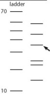 Use the accompanying figure to answer the following question. The bands in the ladder are in 10-base increments, starting with 10 bases at the bottom and going to 70 bases at the top. Approximately how many bases are in the DNA molecule that the arrow is pointing to?   A)  30 bases B)  36 bases C)  40 bases D)  44 bases