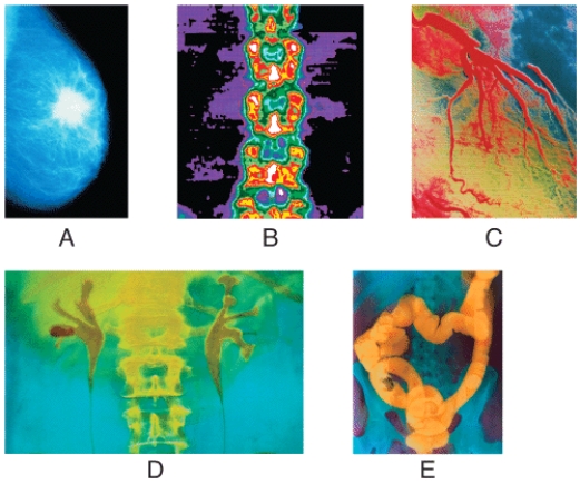 Which radiographs were obtained using low-dose x-rays?   A) (a) and (B)  B) (b) and (C)  C) (c) and (D)  D) (A) and (C)  E) (B) and (e) 