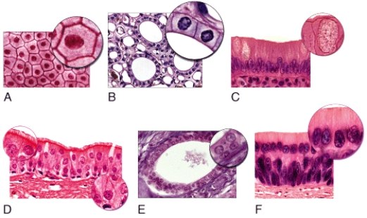 Which of the light micrographs in the figure below shows a stratified cuboidal epithelium?   A) B B) C C) D D) E E) F