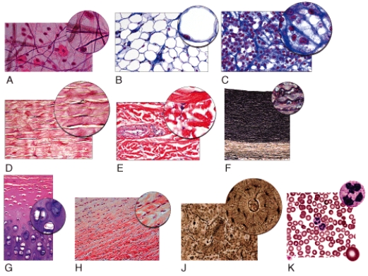 In the figure shown,which light micrograph shows the type of connective tissue that contains the Hardest matrix of all connective tissues?   A) K B) J C) G D) B E) D
