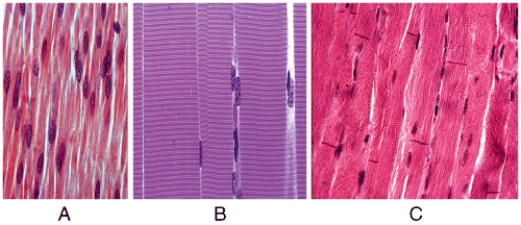In the figure shown,which light micrograph shows cardiac muscle?   A) A B) B C) C D) All of these Answer choices are correct. E) None of these Answer choices are correct.