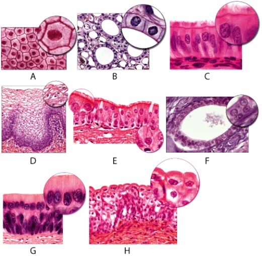 Which of the light micrographs in the following figure shows a type of epithelial tissue whose functions include movement of mucus over their apical surface by ciliary action????1 B?2 C?3 E   A) 1 only B) 2 only C) 3 only D) 2 and 3 only E) All of these Answer choices are correct.