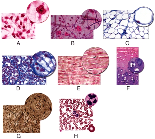 Which of the following figures shows tissue that is found in tendons and ligaments?   A) B B) C C) D D) E E) F