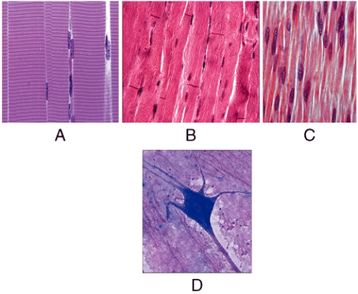 Which is a function of the tissue shown in diagram D?   A) heat production B) pumping of blood C) propulsion of food D) contraction of bladder E) conduct nerve impulses to muscle fibers
