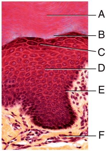 In the photomicrograph of a portion of thick skin shown below,which layer is only seen in thick skin?   A) A B) B C) C D) D E) E