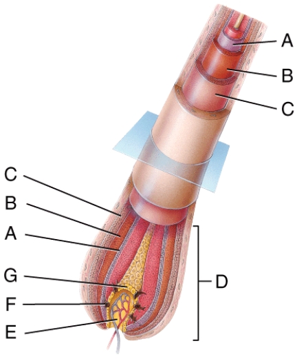 In the diagram,which structure is directly destroyed by electrolysis?   A) A B) B C) C D) F E) G