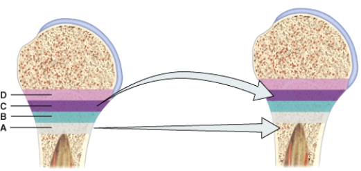 In the diagram,this zone contains mostly dead chondrocytes surrounded by a calcified matrix.   A) A B) B C) C D) D
