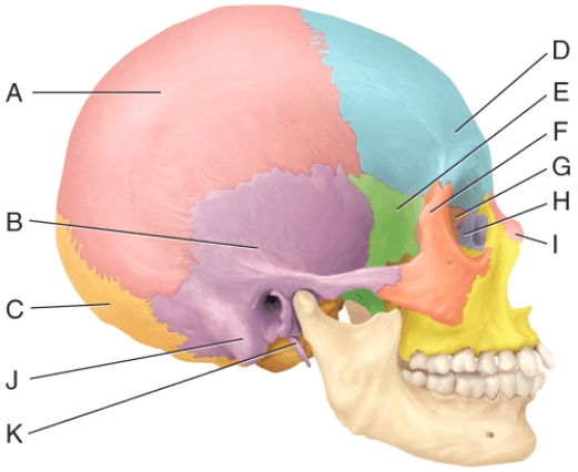 In the diagram,which bone is considered the keystone of the cranial floor?   A) E B) B C) G D) H E) I
