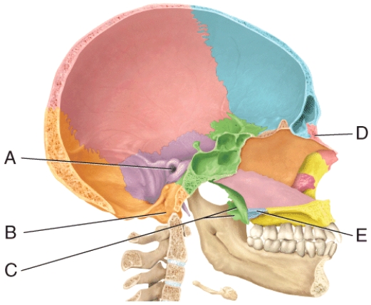 In the diagram,where is the pterygoid process?   A) A B) B C) C D) D E) E