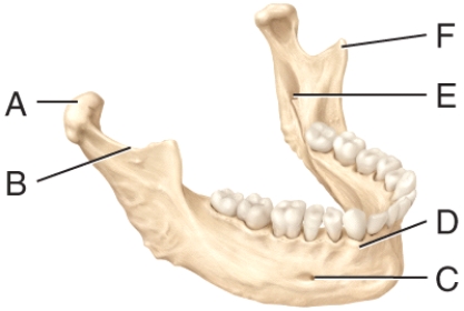 Where is the coronoid process in the diagram?   A) A B) B C) E D) F E) None of these answer choices are correct.