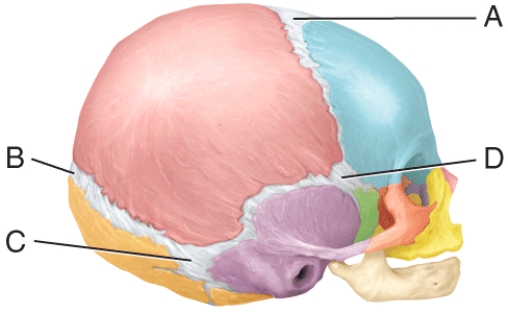 This is largest fontanel in size at birth.   A) A B) B C) C D) D E) Both A and D