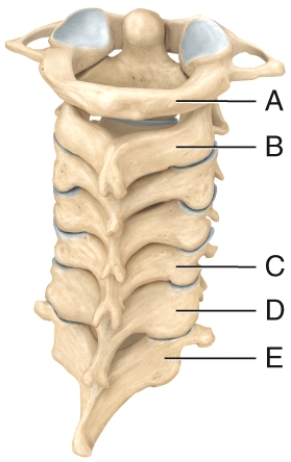 Which of the cervical vertebrae contain a unique process that is responsible for the ability to move your head from side to side signifying  no ?   A) A B) B C) C D) D E) E
