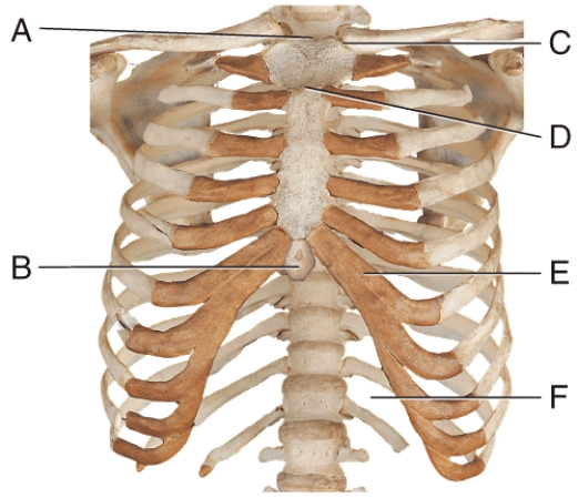 Where is the sternal angle?   A) A B) C C) D D) E E) F