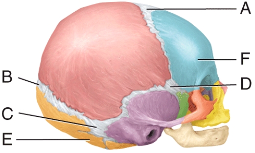 Name the structure labeled B in the diagram   A) posterolateral fontanel B) posterior fontanel C) anterior fontanel D) anterolateral fontanel E) occipital bone