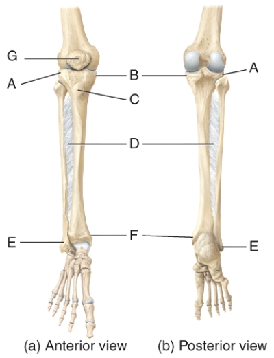 In the diagram of the tibia and fibula,where is the lateral condyle?   A) A B) B C) C D) D E) E