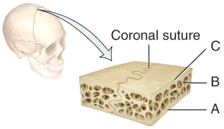 In the below diagram of a suture joint,where is the spongy bone?   A) A B) B C) C D) Both A and C E) Both A and B