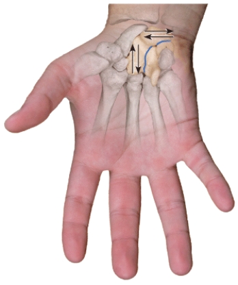 Which type of joint permits this type of movement???1.Synovial joint?2.Cartilaginous joint?3.Fibrous joint   A) 1 only B) 2 only C) 3 only D) Both 1 &2 E) Both 2 & 3