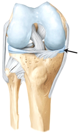 The line is pointing to the _______.   A) lateral lemniscus B) medial lemniscus C) tibial tuberosity D) transverse ligament