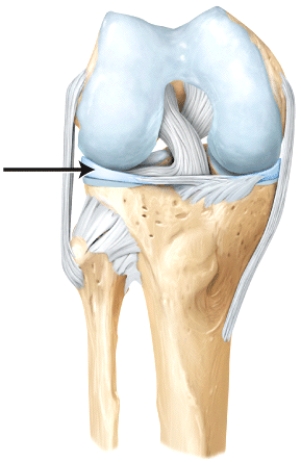 The line is pointing to the _______.   A) lateral lemniscus B) medial lemniscus C) anterior cruciate ligament D) posterior cruciate ligament