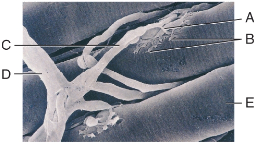 In the diagram,where is the axon terminal?   A) A B) B C) C D) D E) E