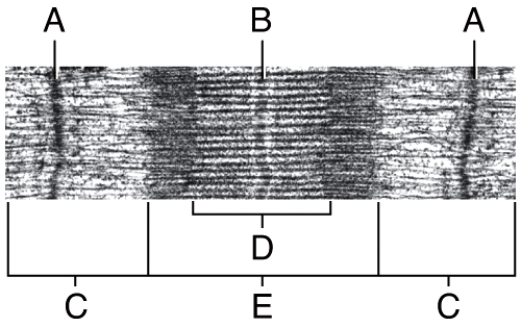 In the diagram,the thin filaments are found in the region labeled ______.   A) C B) E C) B D) Both C and E E) All of these choices