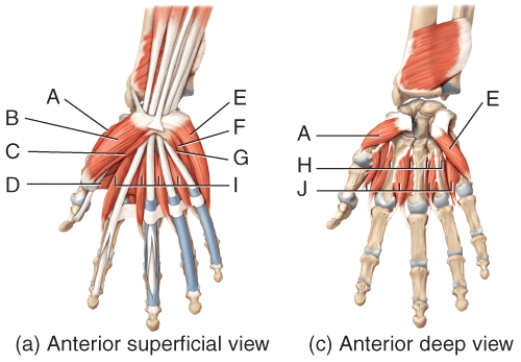 Where is the palmar interossei?   A) F B) G C) H D) I E) J
