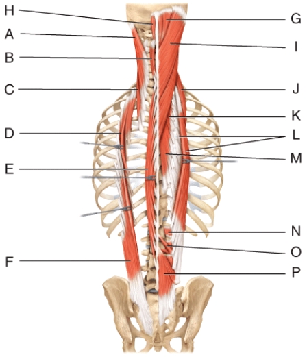 Where is the semispinalis capitis?   A) D B) E C) F D) G E) H