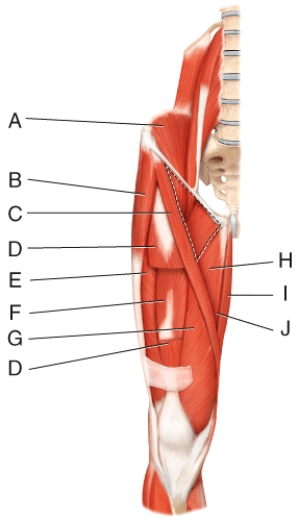 Where is the gracilis?   A) H B) I C) J D) K E) L