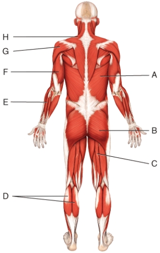 What is the insertion of the muscle labeled A?   A) costal cartilage of the second to sixth ribs B) intertubercular sulcus of humerus C) ulnar tuberosity D) spines of T7-L5 vertebra E) crests of sacrum and ilium