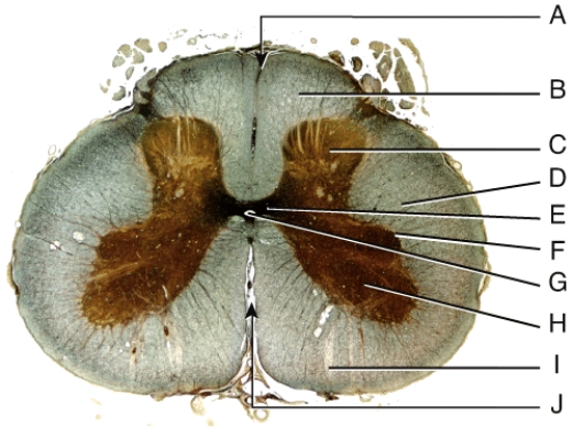 Which portion of the spinal cord contains the cell bodies of somatic motor neurons and motor nuclei?   A) B B) C C) D D) H E) I