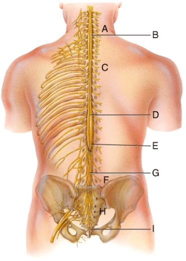 Which of the following structures is labeled E in the diagram?   A) Lumbar enlargement B) Cervical enlargement C) Conus medullaris D) Cauda equina E) Obturator nerve