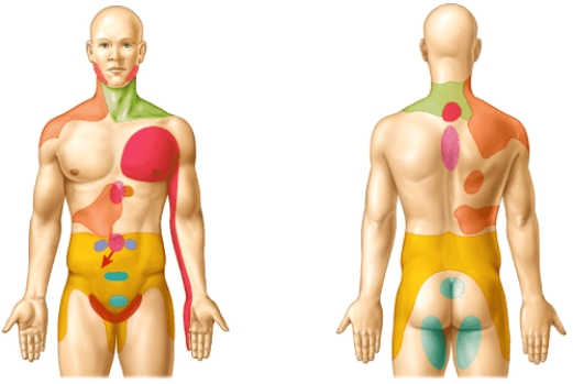 What do colored regions on body's surface in the diagram represent?   A) Dermatomes B) Areas of referred pain C) Regions of nociceptors D) Areas supplied by the primary somatosensory area E) Motor nuclei